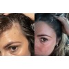 Anti Hair Loss Shampoo Tricostrong 200ml - With Tricofactor Growth