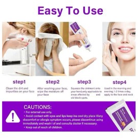 Crema Ácido Azelaico Suero Facial 3pcs Todo Tipo Piel Día Noche