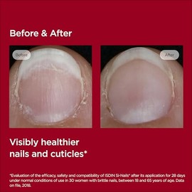 ISDIN SI-NAILS - Tratamiento de suero para cutículas con ácido hialurónico