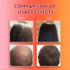 Champú para el crecimiento del cabello con aceite de batana