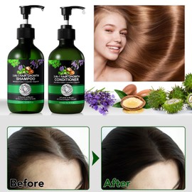 3-in-1 Shampoo and Conditioner Set - 10.56 x 2 fl oz Shampoo and Conditioner Set Made of Black Castor Lavender and Argan Oil for Hair Growth, Sulphate Free, Against Hair Loss for Men and Women (#1)