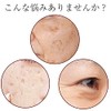 Humanoprasene Solution Aging Care Skin Care Human Placenta 100% Solution