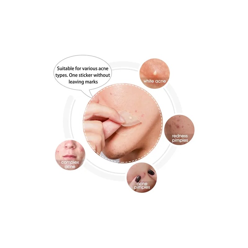Parches Para Acné | Hidrocoloide + Reducción De Imperfeccion