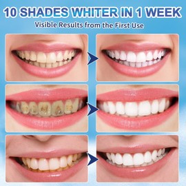 Teeth Whitening Pen(4 Pens), No Sensitivity Teeth Whitening Gel Essence, Effective Tooth Whitener Pen Kit for Dental Brightening, Instant Tooth Whitener Removes Years of Stains, Enamel Safe