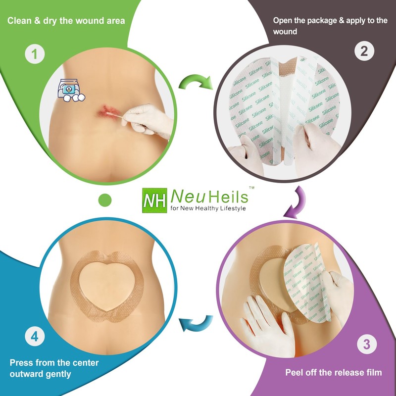 Sacrum Silicone Foam Dressing with Gentle Border for Sacral Ulcer,