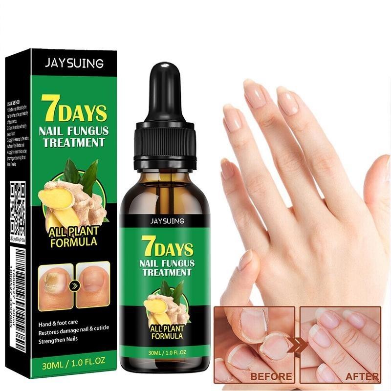 JAYSUING 【Buy 1 Get 1 Free】JAYSUING Ginger Nail CareSerum, Moisturizes,