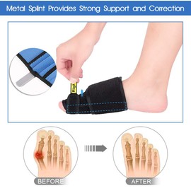 Xrten 1 Paar Hallux Valgus Schiene, Hallux Valgus Korrektur Bandage Nachtschiene Bunion Corrector für Flacher Fuß, Hammer Schmerzlinderung