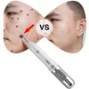 Household Face Mole Removal Pen Dark Spots Plaques Remover Skin