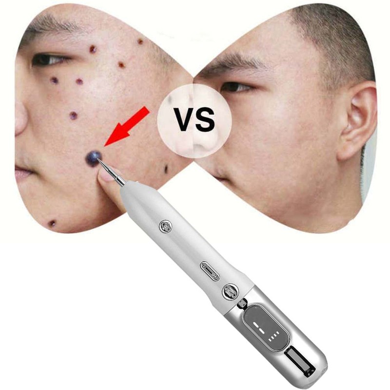 Household Face Mole Removal Pen Dark Spots Plaques Remover Skin