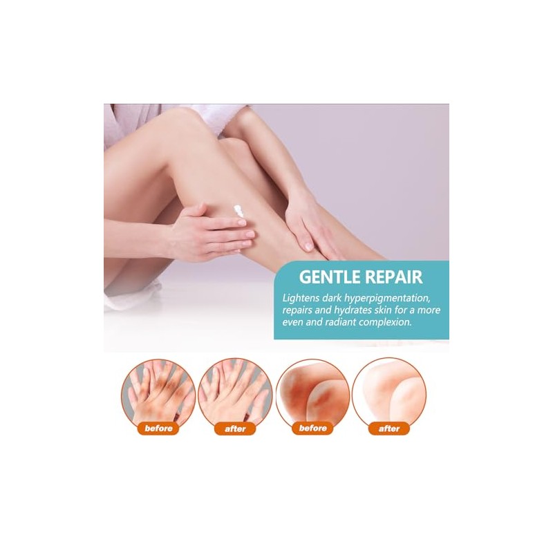 Bluemega Crema Acantosis Nigricans Loción Corporal Hidratante