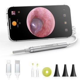 Digital Otoscope Compatible with iPhone and Android Devices, AnyScope HD Ear Camera with Ear Wax Removal Tools, Video Ear Scope Otoscope with Light, Capture Photos and Videos (Silver)