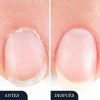 Seralia Lápiz Antihongos 3 Unids, Cuidado Cosmético Uñas /