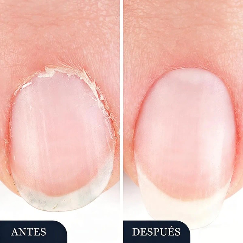 Seralia Lápiz Antihongos 3 Unids, Cuidado Cosmético Uñas /