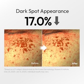 LAYERLAB Suero de aspecto de manchas oscuras con niacinamida al 7% y ácido tranexámico al 3% | Complejo de 13% Radiance Unifica visiblemente el aspect
