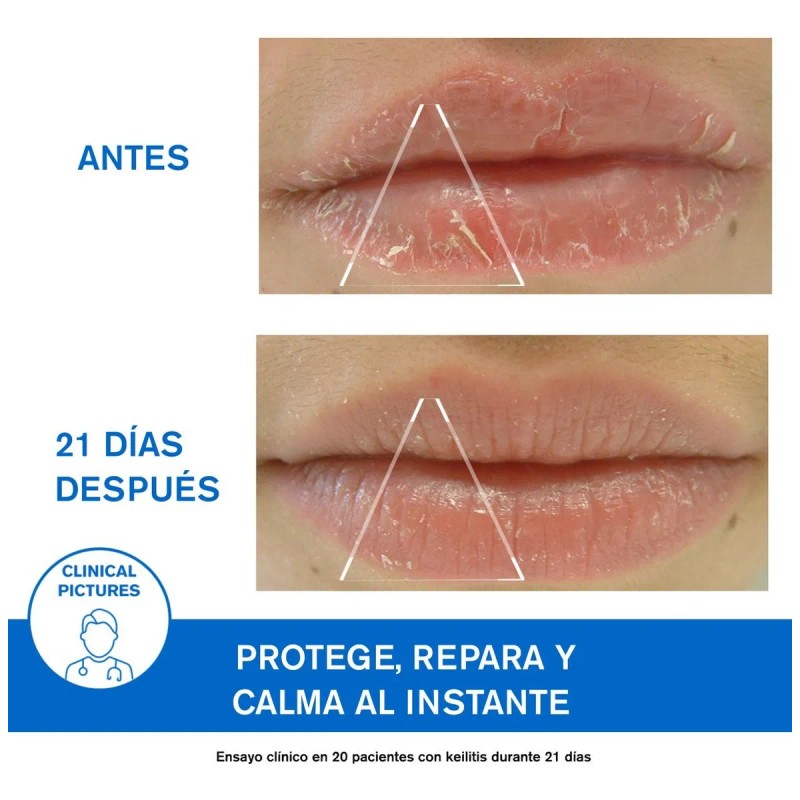 Uriage Bariederm Cica Protecting Lip Balm 15ml