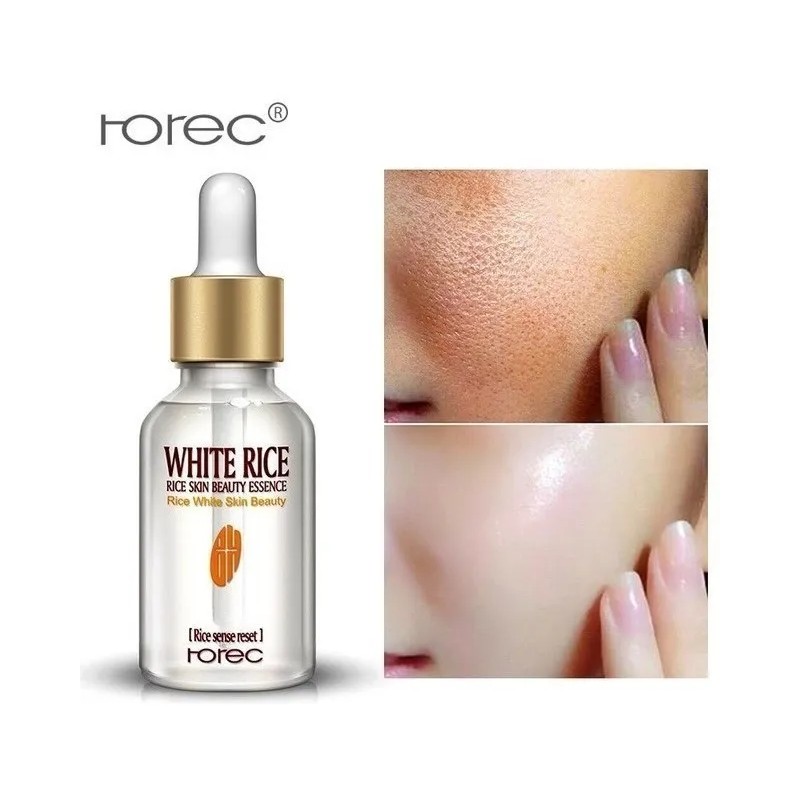 Serum Especializado Cierra Poros Manchas Acné Blanquea Piel Normal