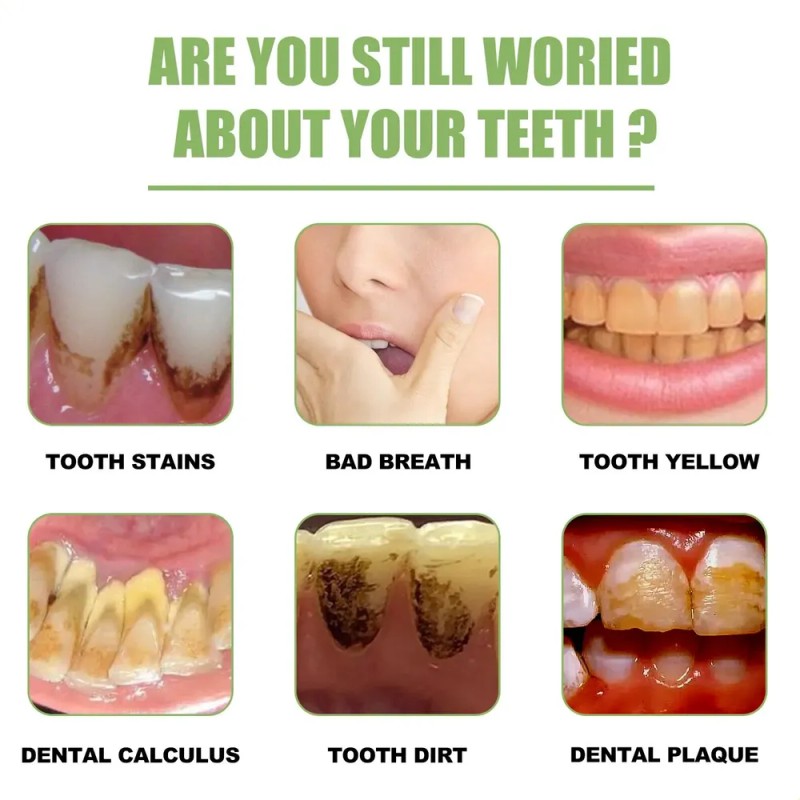 Pacote De 5 Séruns Clareadores De Dentes Eel