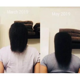 Tc Beauty Organic Hair Growth and Anti Hair Loss Oil   30 Ml For Men & Women