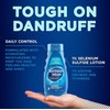 Selsun Blue Normal Oily Hair Anti-Dandruff Shampoo 300ml x3 bottles