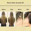 Aceite Vegano Natural Para El Crecimiento Del Cabello, 60 Ml