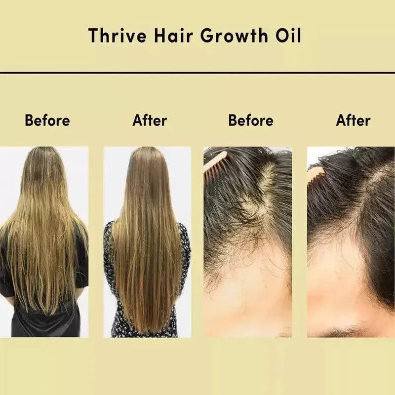 Aceite Vegano Natural Para El Crecimiento Del Cabello, 60 Ml