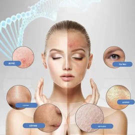 Limpiador Ultrasónico Scrubber Facial Skin Peeling Portatil                                                                                           
