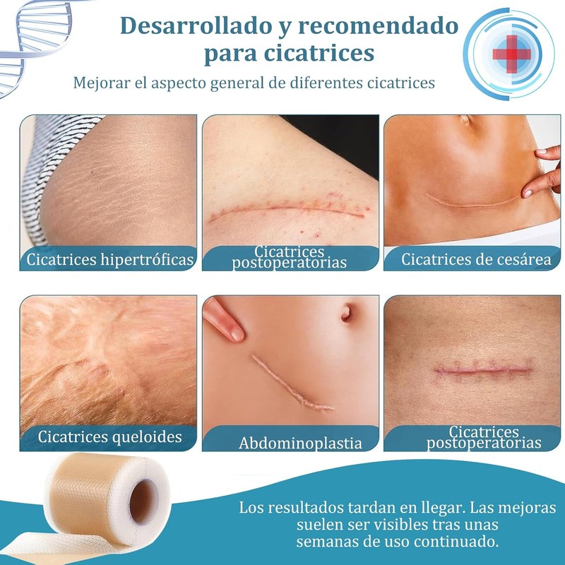 Parches de Silicona para Cicatrices, 2 Rollos Reutilizables e Impermeables