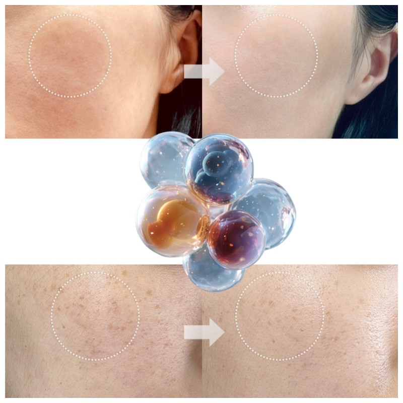 AROCELL Mela TXA Mask 43g*4ea