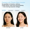 WNP Hyaluronic Acid Hydrating&Soothing Toner: 4D Hyaluronic Acid,Red Algae Extract,Bifida