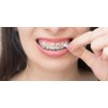 Orthowax - Cera de ortodoncia para usuarios de aparatos ortopédicos,