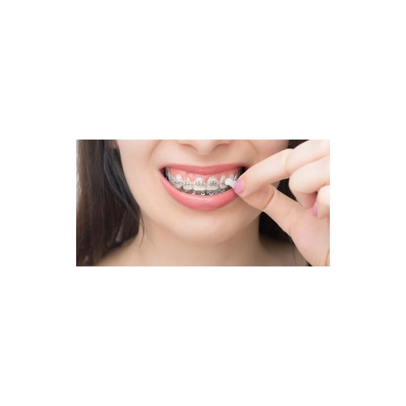 Orthowax - Cera de ortodoncia para usuarios de aparatos ortopédicos,
