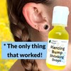 Urban ReLeaf Piercing Bump Shrinking Treatment ! Gentle, Effective Aftercare.