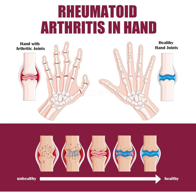 Surllow 3PCS Perfectx Joint & Bone Cream, Perfectx Cream