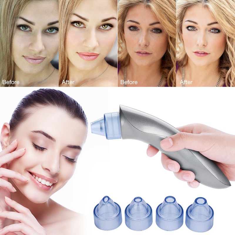 4 Replaceable Heads Blackhead Vacuum Removal Pore Acne Suction Cleanser