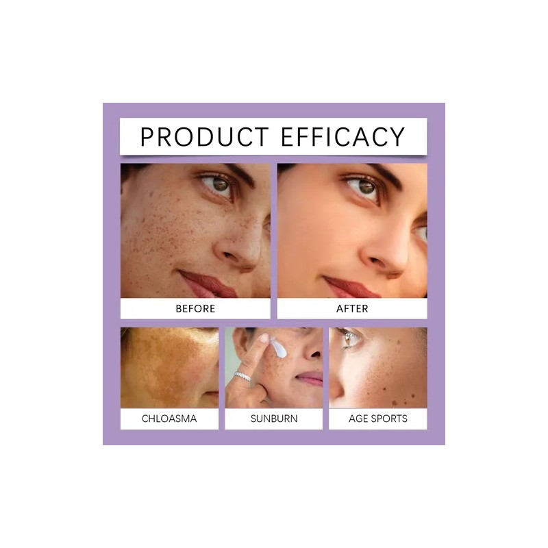 Crema Epiglow Melanex Advanced Anti-hiperpigmentación 3pcs