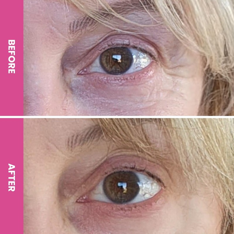 Prime Prometics PrimeEyes Hydrate Under Eye Cream for Mature Women