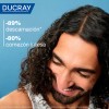 Shampoo Anticaspa Y Come­zón Severa Kelual 100Ml Ducray