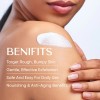 Bump Eraser Cream 4 Oz Soften, Nourish Rough And Bumpy