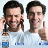 YOEALABY Tinnitus Relief for Ringing Ears, Ringing Relief Drops,Effective in