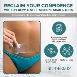 Biodermis . Lámina de silicon ideal para tratar y reducir cicatriz post cesárea (15 x 3.6 cm)