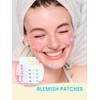 SHEGLAM Daydream Dots Blemish Patches Acne Patch Invisible Pimple Patches