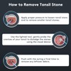 Tonsil Stone Remover with Camera - Upgraded Tonsil Stone Remover