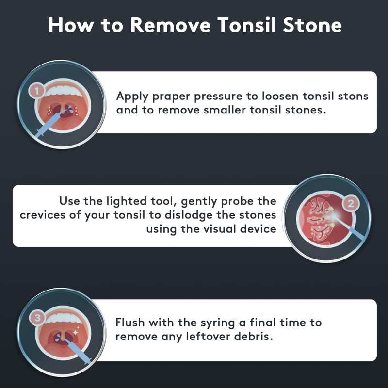 Tonsil Stone Remover with Camera - Upgraded Tonsil Stone Remover
