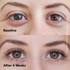 DABALASH Professional Eyelash & Eyebrow Growth Serum with Castor Oil