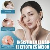 Crema De Anti Acne Reducir El Acné Rojizo 20g