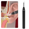 P40 5MP WiFi Ear Cleaning Endoscope Spoon Mini Visual Ear