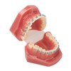 Dental Orthodontic Model 28pcs Teeth Resin Dental Teaching Teeth Model