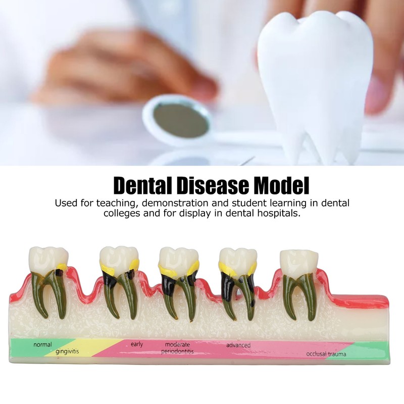 Dental Teeth Model Ceramic Clear Structure Oral Care Educational Periodontal