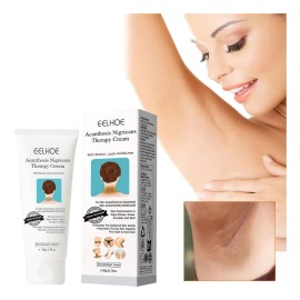 Fixderma Nigrifix Crema Para Acantosis Nigricans Fbg