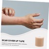 Minkissy 3 Rolls Self Scar Sheet Scar Tape for Arms